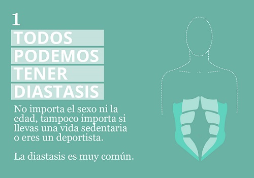 diastasis 1